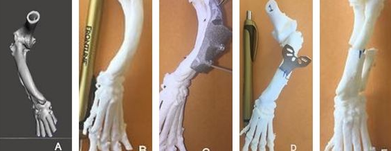 Limb correction
